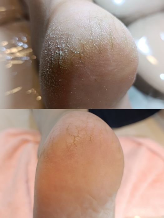 Подолог на выезд