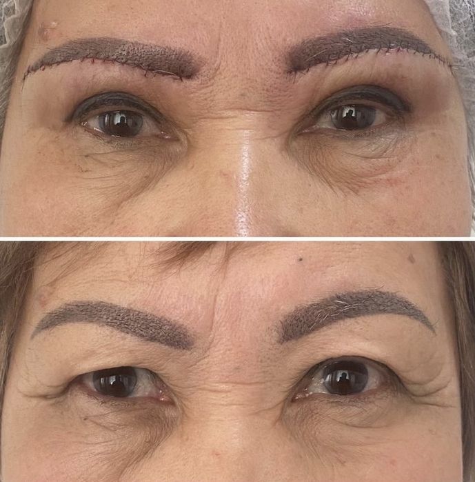 Броулифтинг со скидкой