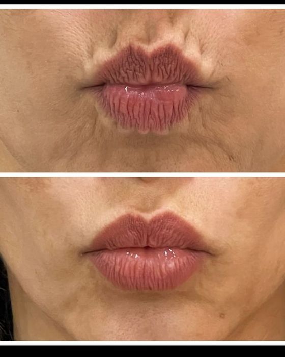 Эстетика красота