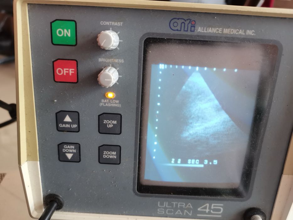 ехограф Ultra Scan 45