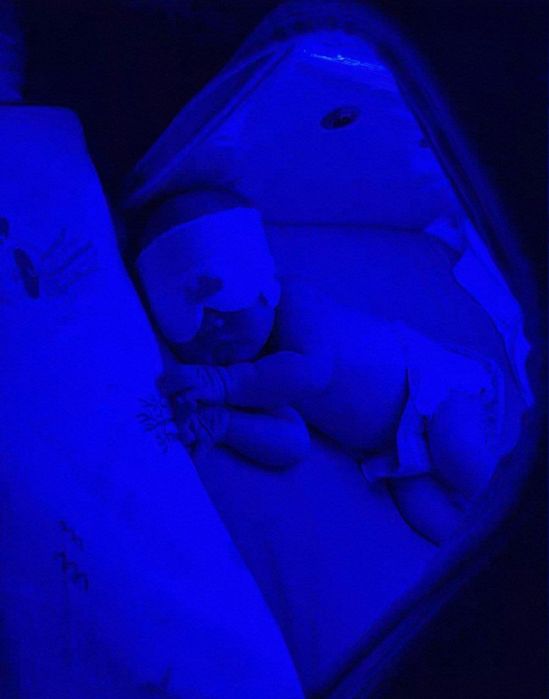 Fotolampa. Fototerapiya. Фотолампа. Фототерапия. 100 000 сум