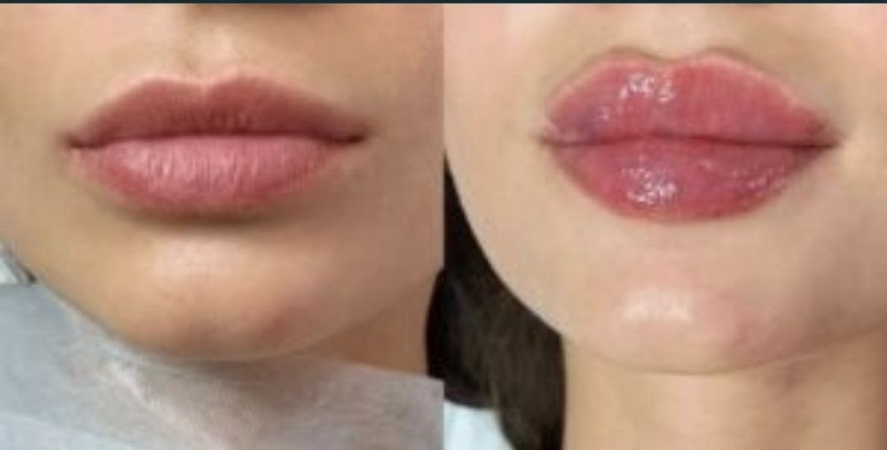 Акция увеличение губ 55$ перманентный макияж губ и бровей