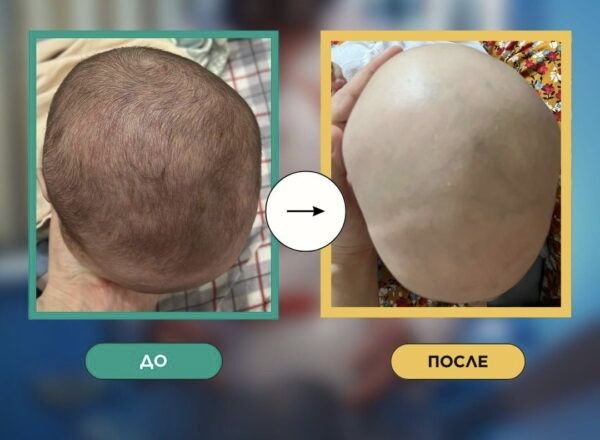 Анатомическая подушка