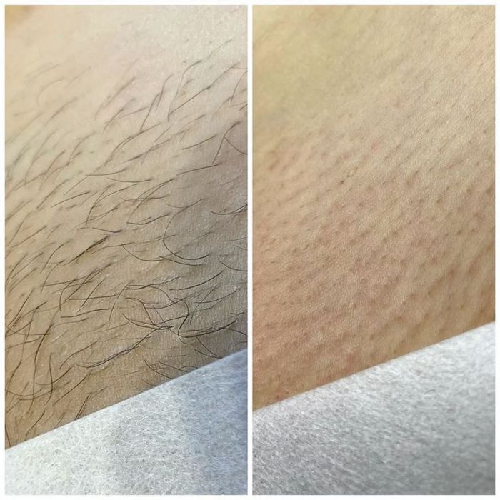 Vosk depilyatsiya | SPA depilyatsiya | Italwax master