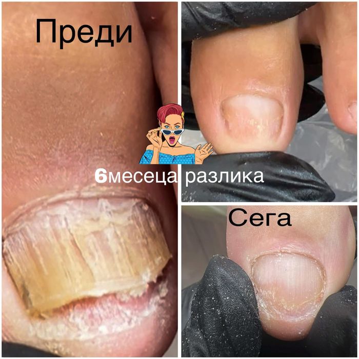 Антимикотична тинтура Peclavus