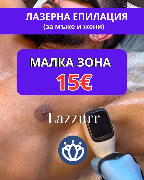 Лазерна епилация