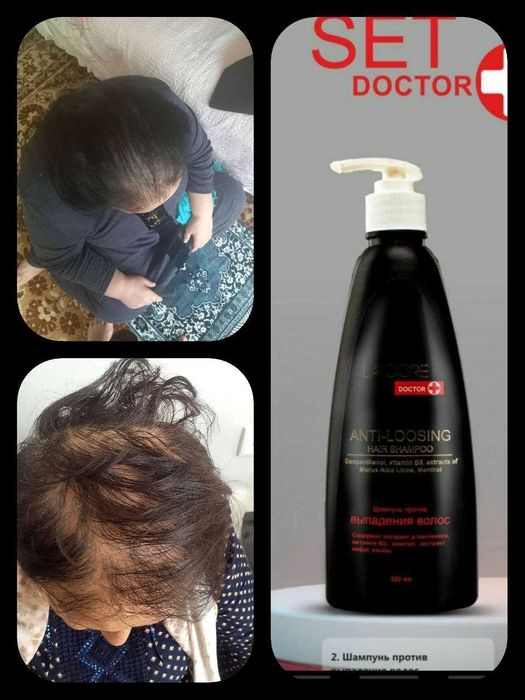 Soch ostiruvchi Shanpoon