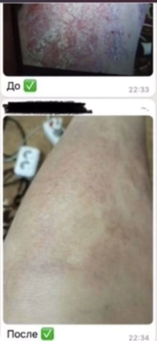 Активатор клеток