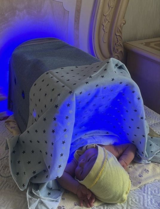 Лампа для желтушки