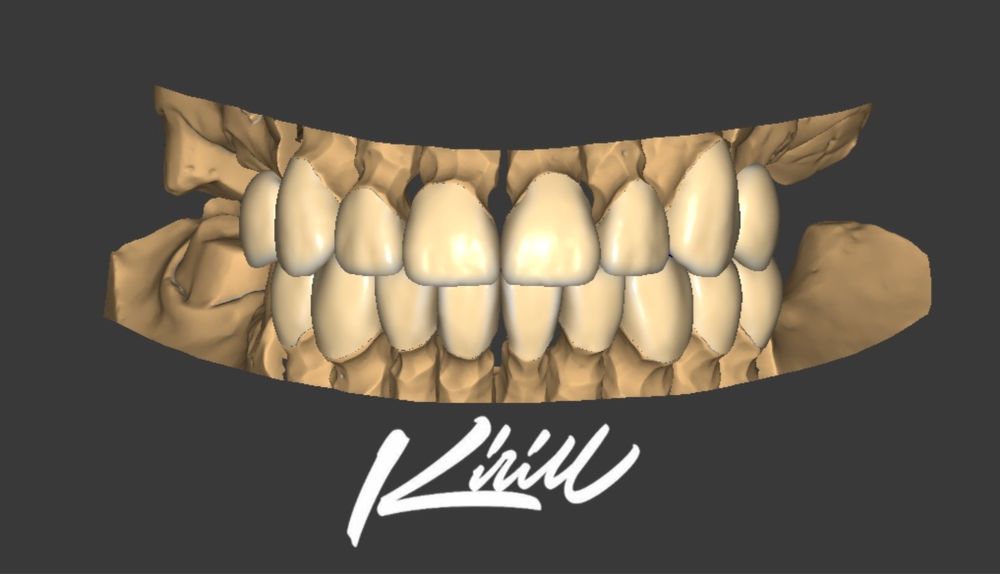 Моделирование зубов (exocad/blender)