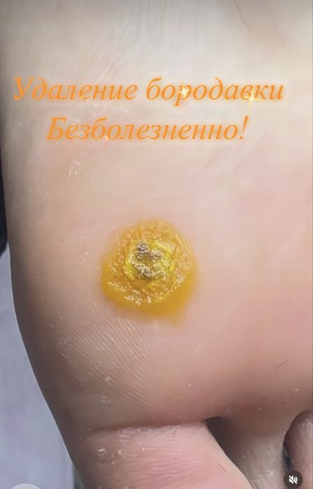 • Подология • Лечение ногтей