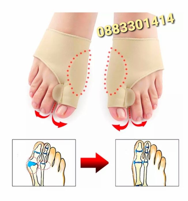 Намаление! Комплект Коректор за пръстите на краката