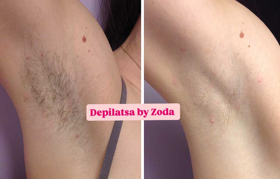 Depilatsiya faqat ayyollar qizlar uchun