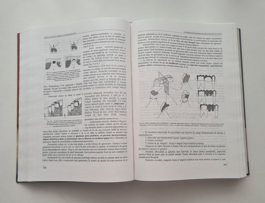 Bazele clinice si tehnice ale protezarii fixe - Bratu