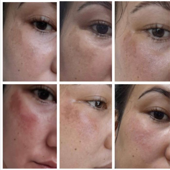 Expigment 4% крем — для отбеливания кожи окартирувчи крем