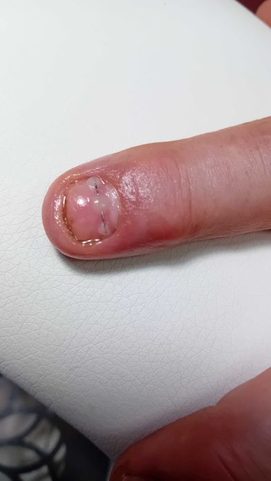 Podologica Pedichiura complexa