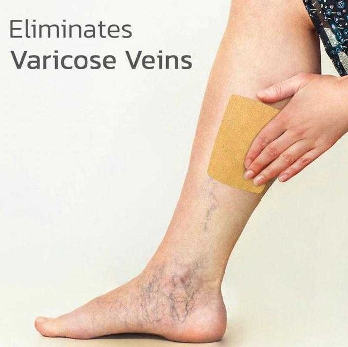 12 броя Пластир за Разширени Вени Лепенка за Лечение на Разширени Вени