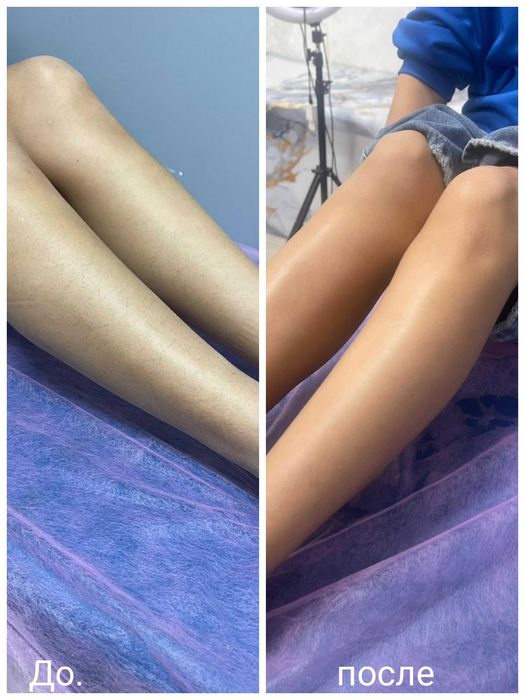 Шугаринг бикини+подмышки=3000тг