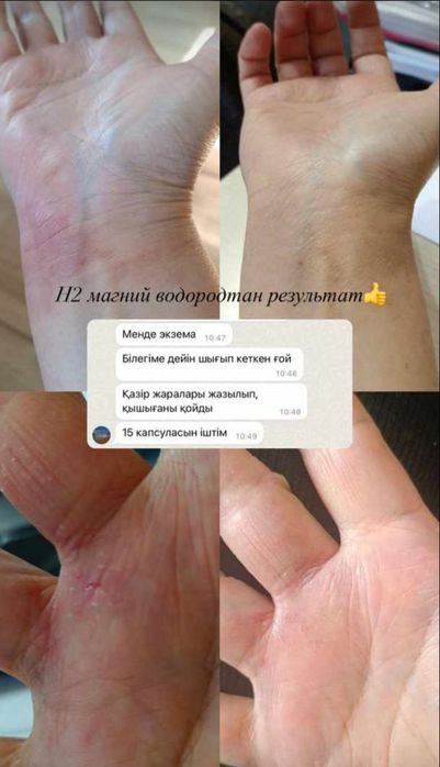 Продам магний водород