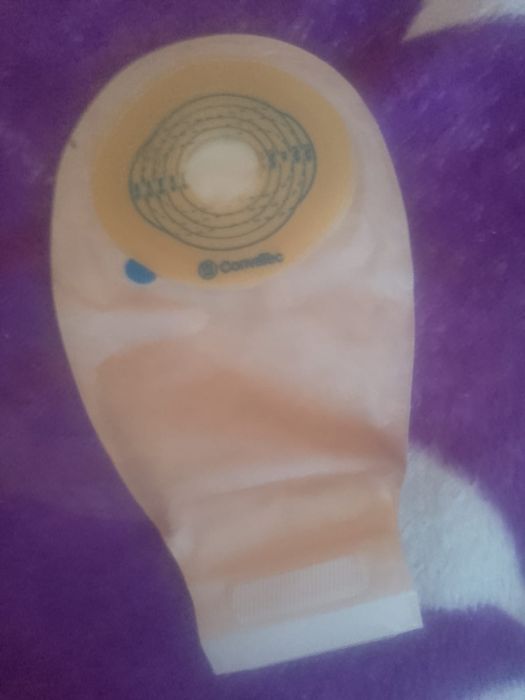 Vanda Pungi colostoma