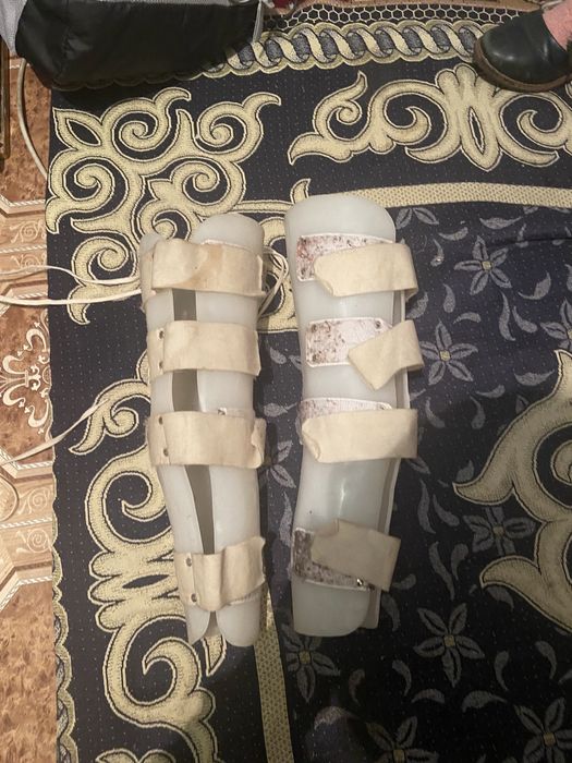 Аппарат ортопедический