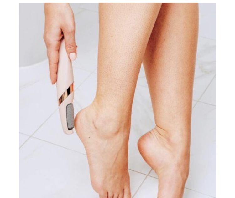 Aparat pentru curatat calcaie ajuta la îndepartarea bataturilor