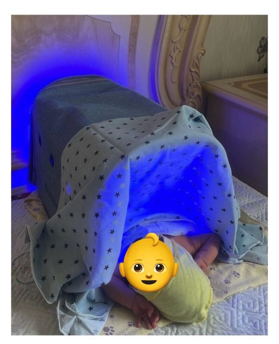 Фотолампа от желтушки