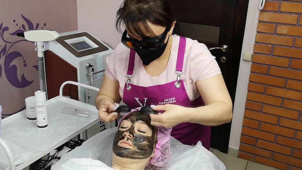 Карбоновый пилинг,7000  омоложение