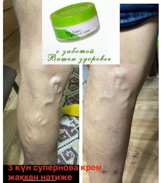 Супер нова крем