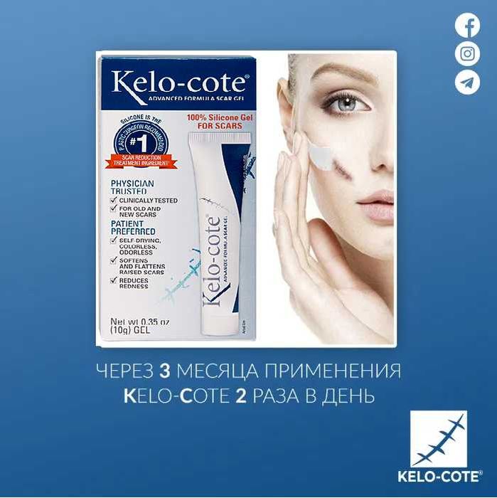 Kelo-Cote 10g-60g- силиконовый гель для рассасывания рубцов