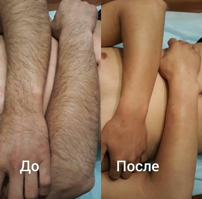 Депиляция всех зон для мужчин