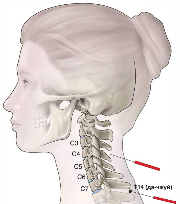 Семинар по обезболиванию болей в спине / Белдаги оғриқларни йўқотиш