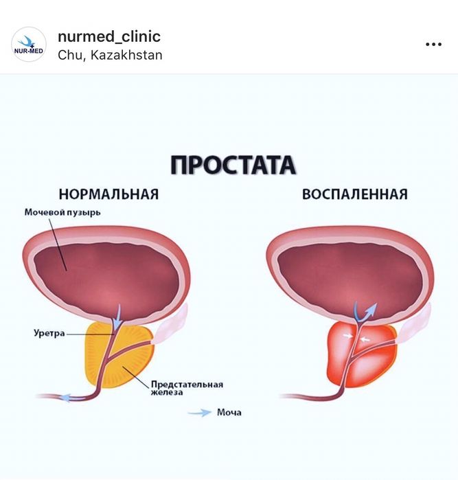 Врач уролог высшей категории.