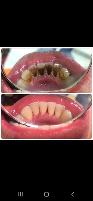 Все виды стоматологии