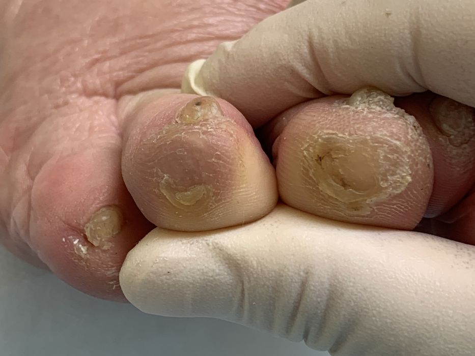 Проблемы с ногами (стопами) и ногтями