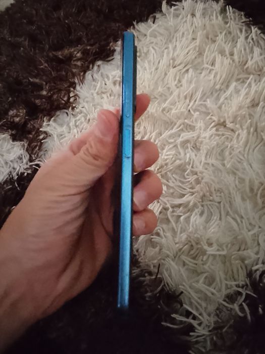 Redmi not 11 holati ideal