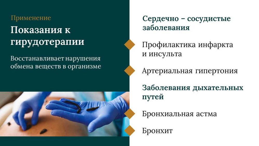Лечение медицинскими пиявками (гирудотерапия)