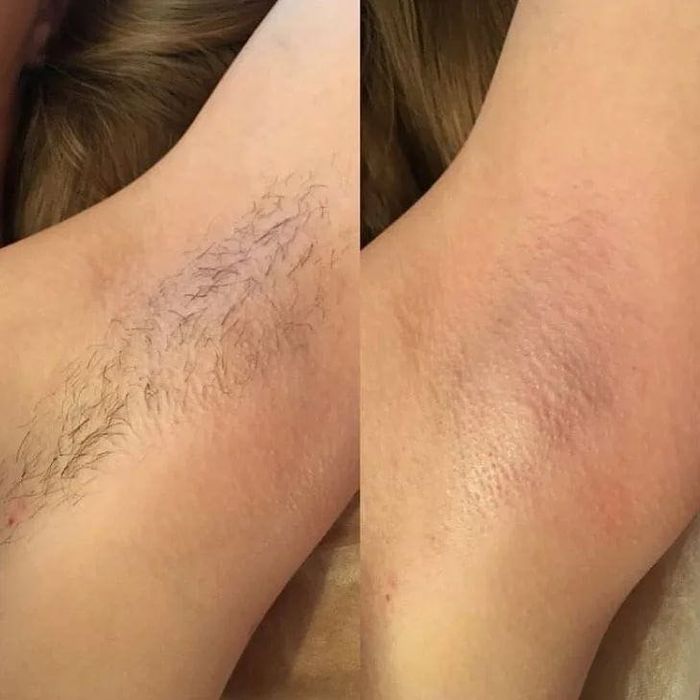 Шугаринг выезд на дом 1000 тг