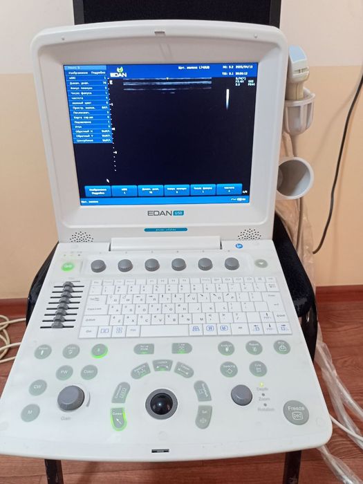 УЗИ Edan U50 prime edition