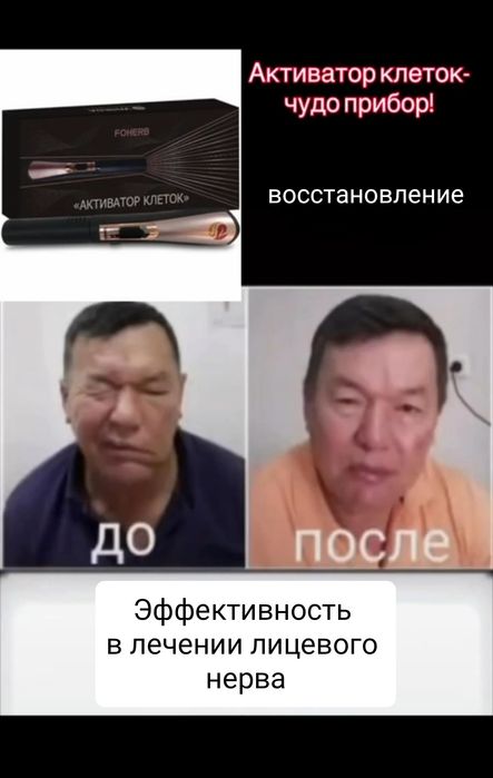 Прибор активирует клетки. Оригинал