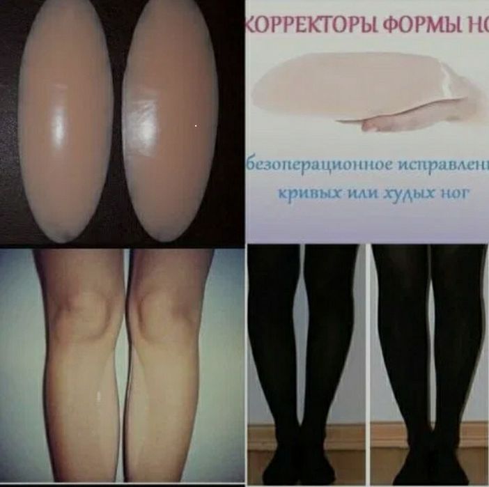 Накладки для кривых ног