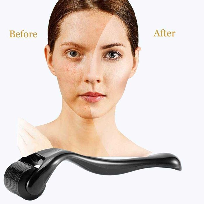 Дерма ролер 540 титаниеви игли, Срещу оплешивяване, Подмладява кожата