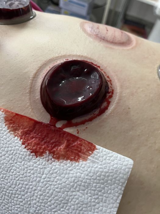 Хиджама в г.Актау