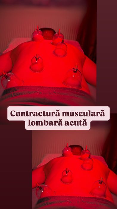 Masaj/kinetoterapie/chiropractica/acupunctura/recuperare
