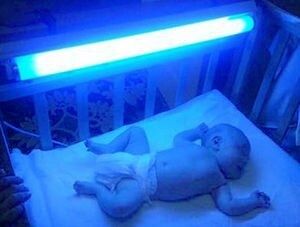 Фотолампа от желтухи