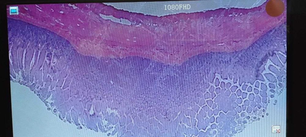 Микроскоп электронный с 7-дюймовым экраном и 12 м камерой.