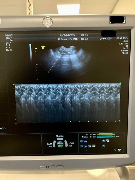 RIC5-9D - Sonda transvaginala 3D/4D Voluson E8 / E10 General Electric
