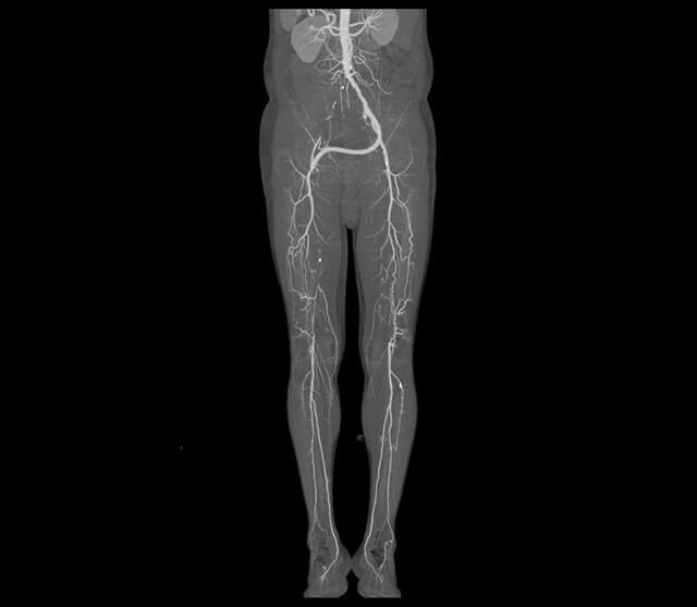 Компьютерный томограф КТ 16,32,64,128 среза.