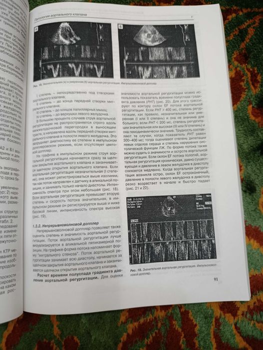 Книги по УЗИ Митькова