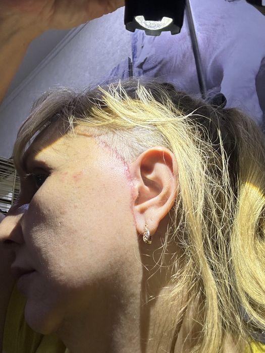 Чихуахуа беби фейс